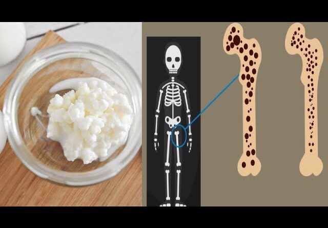 4 Benefits of Kefir, Check the Latest