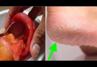 Goodbye HARDNESS of the feet with these homemade tricks